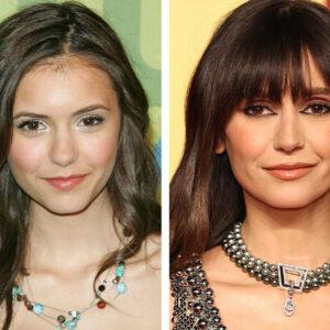 Nina Dobrev proudly advocates for aging naturally under the bright lights of the spotlight.